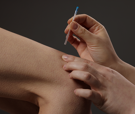 PRP therapy gainesville