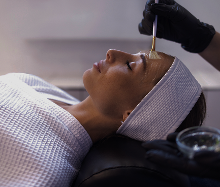 chemical peels gainesville