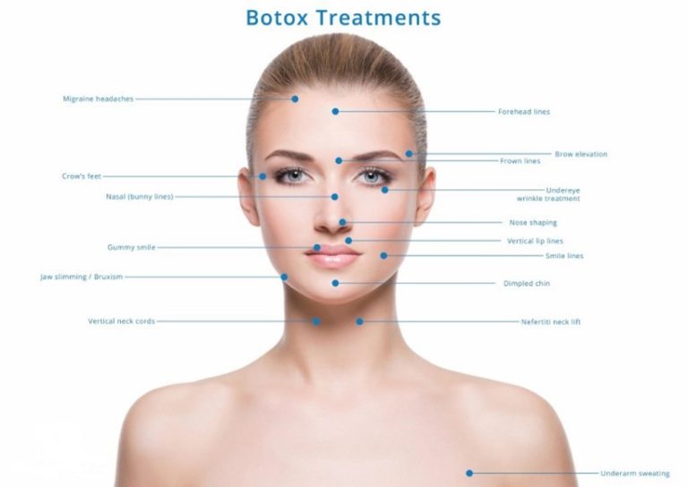 BOTOX service image for Fairfax VA